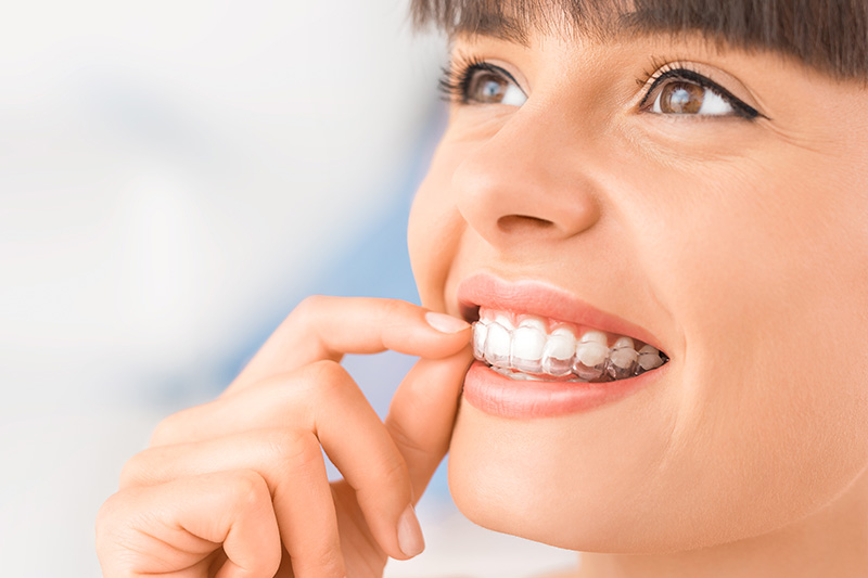 Invisalign in Kansas City